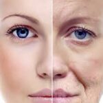 Anti-Aging